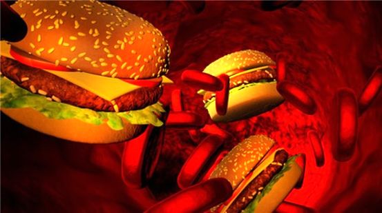 Umgang mit hohem Cholesterin: Wie Sie an Ihrem Behandlungsplan festhalten