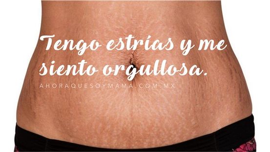 Marcas de estiramiento en las rodillas: causas, eliminación y prevención
