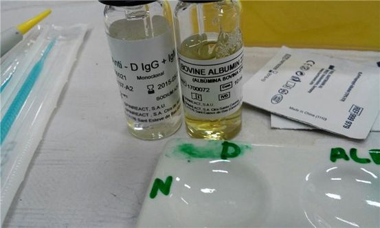 Prueba de albúmina en suero: Propósito, Procedimiento, y Results