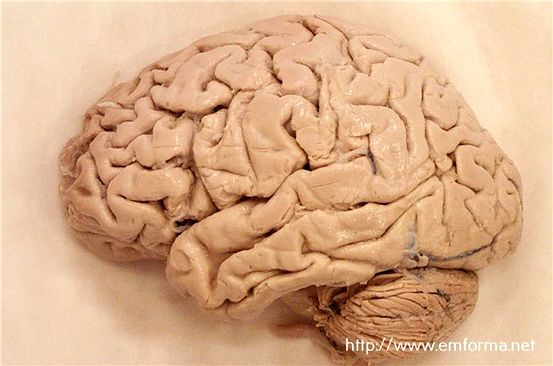 Líquido cerebroespinal Cultivo: Propósito, procedimiento y riesgos