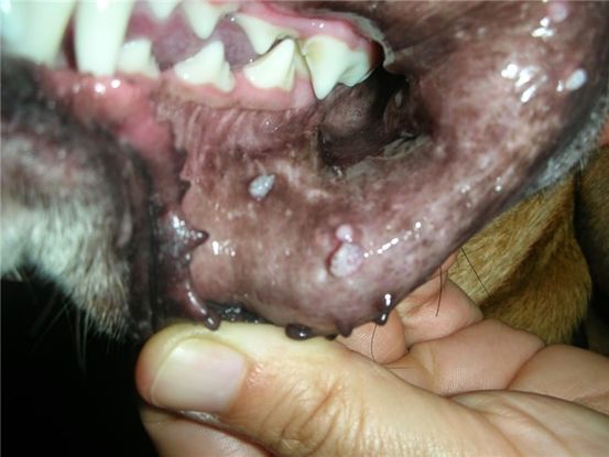 HPV en la boca: síntomas, prevención, diagnóstico y más
