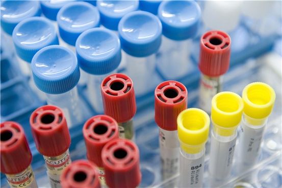 Analisi del sangue di catecolamina: scopo, procedura e preparazione