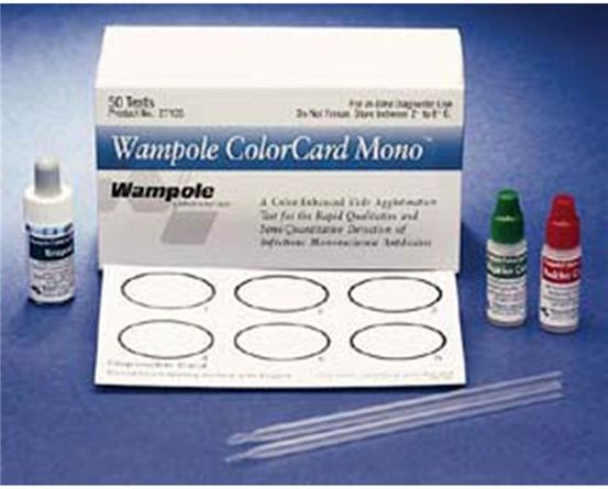Mononucleosis Spot-test: Overzicht, procedure en complicaties