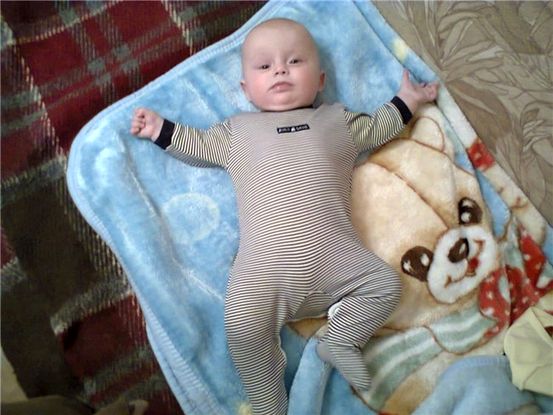 Недоношенный Младенец