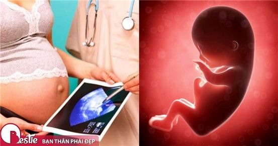 10 Sớm Các dấu hiệu của Lupus