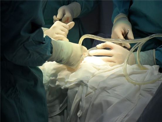 Phẫu thuật cắt lớp đại tràng tiến bộ